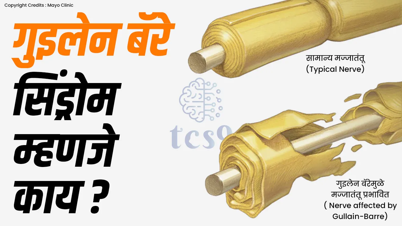 What is Guillain-Barre Syndrome, What is GBS, GBS ajar mhanje kay, GBS ajar kasa hoto, GBS ajarachi lakshane konti, GBS ajaravar upchar, treatment, antibiotics, antibody, vinyan ani tantradnyan notes marathi madhe, Rog ani ajar MPSC notes, arogya sevak bharti notes, Plasma Exchange treatment, neurological disorder, Georges Guillain, Jean Barré, french neurologists, What is Guillain-Barré syndrome in India?, How to prevent GBS syndrome?, What antibiotic kills GBS?, tcs chalu ghadamodi, ibps chalu ghadamodi, current Affair,  chalu Ghadamodi Marathi,   current Affair marathi madhe, 2024 cha chalu Ghadamodi,   police Bharti chalu Ghadamodi,   police Bharti prashnasanch,   police Bharti GK prashna,   Mpsc chalu Ghadamodi,   sarkari Naukri,   sarkari job,   sarkari yojna,   Maharashtra cha chalu Ghadamodi,   Maharashtra government yojna,   PSI syllabus, PSI cutoff,   police Bharti syllabus,   police Bharti cutoff,   police Bharti merit,   MPSC Sathi book,   MPSC Sathi pustak,   police Bharti Sathi pustak,   police Bharti magil prashnapatrika,   MPSC previous years question papers,   Mumbai police Bharti,   Mumbai police Bharti Lekhi kadhi ahe,   government GR,   police Bharti result,   MPSC result,   SSC GD merit,   sscgd syllabus,   army Bharti merit,   army Bharti result,   UPSC Marathi,   combine pariksha,   talathi,   talathi syllabus,   talathi cutoff,   talathi book list,   talathi result,   talathi merit,   talathi jaga kiti ahe,   saralseva exam,   saralseva pariksha,   saralseva result,   zilha parishad Bharti,   zilha parishad prashnapstrika, dinvishesh, Chalu Ghadamodi Marathi madhun, current Affair marathi madhe, headline-news, maharashtra-news, jhattpatt-batmya, pib, marathi batmya, government new channel, Pib, akashvani, the Hindu, Indian express, Loksatta, Lokmat, Dainik Bhaskar, sansad news, editorial, sampadkiya, vishleshan, Loksabha news, rajyasabha news, SSC GD notes, sscgd question papers, sscgd exam answer, results, SSC GD admit card, sscgd ground, exam centre, mpsc main answer writing, maharashtra police recruitment 2025, maharashtra police exam updates, maharashtra police bharti latest news, maharashtra police exam calendar 2025, maharashtra police exam syllabus pdf download, maharashtra police bharti exam pattern 2025, maharashtra police constable syllabus, physical test details maharashtra police, maharashtra police bharti admit card 2025, maharashtra police hall ticket download, maharashtra police exam admit card date, maharashtra police study material pdf, maharashtra police exam preparation tips, maharashtra police mock tests free, best books for maharashtra police exam, maharashtra police bharti previous year papers pdf, maharashtra police constable sample papers, maharashtra police si model question papers, maharashtra police eligibility criteria 2025, age limit for maharashtra police bharti, educational qualification maharashtra police, maharashtra police result 2025, maharashtra police merit list, maharashtra police exam cutoff marks, maharashtra police online application 2025, maharashtra police physical test details, document verification for maharashtra police bharti, maharashtra police recruitment 2024, maharashtra police exam calendar 2024, maharashtra police bharti exam pattern 2024, maharashtra police bharti admit card 2024, maharashtra police eligibility criteria 2024, maharashtra police result 2024, maharashtra police online application 2024, RRB Group D, Railway Group D, Railway Recruitment Board Group D, Railway Group D Exam, Railway Group Notification, Railway Group D Vacancy, Railway Group D Syllabus, Railway Group D Eligibility, Railway Group D Application, Railway Group D Admit Card, Railway Group D Result, Railway Group D Cut Off, Railway Group D Salary, Railway Group D Jobs, RRB Group D Study Material, RRB Group D Previous Papers,  RRB Group D Mock Tests, RRB Group D Exam Pattern, current Affair, General Science, GK, GS, General  Awareness, current  affairs marathi , Mathematics, General Intelligence and reasoning, RRB chalu Ghadamodi, RRB Group D marathi notes, samanya vinyan, samanya, nyan, railway notes marathi madhe, railway pagar, pagar ani bhatta, railway bharti notes marathi, railway bhartichi tayari kashi karaychi, railway bharti magil varshanche prashnapatrika, railway bhartipyq, railway bharti prashnasanch, railway bharti test paper, railwetvnokrichi sandhi, railway job, railway bharticha syllabus, railway bharti pattern, railway bharti imp prashn, railway bhartila vicharle janare prashn, competitive exam, spardha parisha, railway bharti online class, railway bharti class, railway bharti chi tayari kashi karaychi,  RRB Group D Syllabus, RRB Group D Previous Papers, RRB Group D Exam Pattern, RRB Group D Eligibility Criteria, RRB Group D Notification, RRB Group D Application, RRB Group D Admit Card, RRB Group D Result, RRB Group D Cut Off, RRB Group D Salary, RRB Group D Jobs, RRB Group D Coaching, RRB Group D Study Material, RRB Group D Mock Tests, Railway Group D Level 1, RRB Group D 2025, RRB Group D Level 1, RRB Group D Posts, RRB Group D Exam Pattern, RRB Group D Exam Date, RRB Group D Online Application, RRB Group D Previous Papers, RRB Group D Preparation Tips, RRB Group D Study Material, RRB Group D Coaching, RRB Group D Mock Tests, How to prepare for RRB Group D exam, RRB Group D exam syllabus 2025, RRB Group D eligibility criteria 2025, RRB Group D application form 2025, RRB Group D admit card download, RRB Group D result date 2025, RRB Group D cut off marks 2025, RRB Group D salary and allowances, Best books for RRB Group D exam, Online coaching for RRB Group D, Railway Group D , RRB Group D, Railway Jobs , Government Jobs, Railway Recruitment, RRB Group D Exam, Railway Group D Vacancy, RRB Group D Notification, Railway Group D Application, RRB Group D Salary