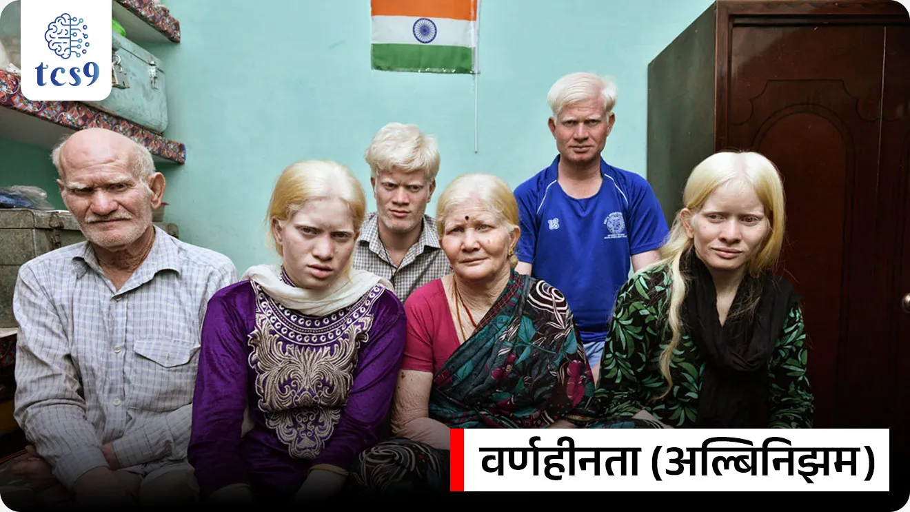 आंतरराष्ट्रीय अल्बिनिझम जागरूकता दिन
International Albinism Awareness Day


📚 Subject : GS - दिनविशेष, विज्ञान आणि तंत्रज्ञान - रोग आणि आजार

सरळसेवा, तलाठी, वनरक्षक, पोलीस भरती, अग्निवीर , रेल्वे भरती, SSC GD, MPSC, UPSC परीक्षेसाठी विचारलेले / संभाव्य महत्त्वपूर्ण  प्रश्न


प्रश्न) आंतरराष्ट्रीय अल्बिनिझम जागरूकता दिन केव्हा साजरी केला जातो ?

31 मे
13 जून
21 जून
28 जून

उत्तर :  13 जून

📰 बातमी काय ? 
दरवर्षी 13 जून रोजी 'आंतरराष्ट्रीय अल्बिनिझम जागरूकता दिन' साजरा केला जातो.

🤔 मेलॅनिन (Melanin) द्रव्य नेमकं  काय असतं ?
मानवी त्वचेमध्ये कृष्णरंजक म्हणजेच मेलॅनिन (Melanin) हे द्रव्य असते, जे त्वचेला रंग प्राप्त करून देते.
गडद म्हणजे सावळ्या, काळ्या त्वचेमध्ये मेलॅनिन द्रव्याचे प्रमाण जास्त असते. 
या कृष्णरंजक द्रव्याच्या उपस्थितीमुळे शरीराचे सूर्याच्या अतिनील किरणांपासून संरक्षण होते. 
कृष्णरंजक द्रव्याची निर्मिती ही प्रामुख्याने अनुवांशिक घटकांद्वारे नियंत्रित केली जाते. 

🤔 वर्णहीनता (अल्बिनिझम) म्हणजे काय ? 
🧐 What is Albinism ? 
वर्णहीनता (Albinism/अल्बिनिझम) हा एक दुर्मिळ अनुवांशिक स्थिती आहे, ज्यामध्ये शरीरात 'मेलेनिन' (melanin) नावाचे रंगद्रव्य तयार होत नाही किंवा खूप कमी प्रमाणात तयार होते.
वर्णहीनता म्हणजे कोड होय. यास विवर्णता किंवा धवलता असेही म्हणतात. 
माता व पिता हे दोघेही कोडाच्या व्याधीने ग्रस्त असतील, तर ही अवस्था पुढील पिढीत संक्रमित होण्याची शक्यता असते.
अल्बिनिझम हे संसर्गजन्य नाही म्हणजेच कोड असलेल्या व्यक्तींचा संपर्क इतर व्यक्तींशी आला, तरी त्याची लागण दुसऱ्याला होत नाही.
यात व्यक्तिंची त्वचा, केस पांढरे असतात. 
काही वेळेस डोळ्यांची बुबुळे गुलाबी अथवा रंगहीन असतात.
अल्बिनिझम असलेल्या लोकांना मेलेनिनच्या कमतरतेमुळे अनेक आरोग्य समस्यांना सामोरे जावे लागते. 
त्यांना त्वचेचा कर्करोग होण्याची शक्यता जास्त असते. 


🧐 'आंतरराष्ट्रीय अल्बिनिझम जागरूकता दिन' का साजरी करण्यात येतो ?
🤔 'आंतरराष्ट्रीय अल्बिनिझम जागरूकता दिन' या दिवसाचा उद्देश कोणता ? 

अल्बिनिझम म्हणजे काय, त्याचे परिणाम काय आणि या स्थितीत असलेल्या व्यक्तींना कोणत्या आव्हानांना सामोरे जावे लागते, याबाबत जागरूकता वाढविण्यासाठी.
अल्बिनिझम असलेल्या व्यक्तींविरुद्ध होणारा भेदभाव, गैरसमज आणि हिंसाचार थांबवण्यासाठी.
अल्बिनिझम असलेल्या व्यक्तींना समाजात समान संधी मिळाव्यात यासाठी प्रयत्न करण्यासाठी आणि त्यांना मुख्य प्रवाहात आणण्यासाठी दरवर्षी 13 जून रोजी 'आंतरराष्ट्रीय अल्बिनिझम जागरूकता दिन' म्हणून साजरा केला जातो.

🤔 पहिला 'आंतरराष्ट्रीय अल्बिनिझम जागरूकता दिन' केव्हा साजरी करण्यात आला ?
13 जून 2015 रोजी पहिला 'आंतरराष्ट्रीय अल्बिनिझम जागरूकता दिन' साजरी करण्यात आला.

🧐 आंतरराष्ट्रीय वर्णहीनता जागरूकता दिनासाठी २०२६ ची मुख्य संकल्पना (थीम) कोणची ?
"माझ्या त्वचेचा मला अभिमान आहे - सर्व त्वचा रंगांचा उत्सव साजरा करणे" (“Proudly in my skin:  celebrating all skin tones”) ही 2026 साठीची संकल्पना (थीम) आहे.

परीक्षेच्या दृष्टीने IMP रिव्हिजन पॉईंट्स : Albinism
 आंतरराष्ट्रीय अल्बिनिझम जागरूकता दिन → 13 जून 
 पहिला केव्हा साजरा झाला → 13 जून  2015 रोजी
 अल्बिनिझम (वर्णहीनता) स्थिती → हा एक दुर्मिळ अनुवांशिक (Genetic) आजार, (तो संसर्गजन्य नाही)
 मानवी त्वचेला आणि केसांना रंग देणारे मुख्य द्रव्य → मेलॅनिन (Melanin - कृष्णरंजक).
वर्ष २०२६ ची संकल्पना (Theme) → माझ्या त्वचेचा मला अभिमान आहे - सर्व त्वचा रंगांचा उत्सव साजरा करणे


“Proudly In My Skin: Celebrating All Skin Tones", International Albinism Awareness Day theme 2026, Antarrashtriya Albinism Jagrukta din, International Albinism Awareness Day, What is albinism?, Albinism Mhanje kay, kod ka hotat, Albinism kasa hoto, vivarnata, dhavalta, melanin mhanje kay, melanin kkay kam kart, risk of skin cancer, #iaad2025 #sunscreenisadrug #albinism, Health challenges of people living with albinism, vinyan ani tantradnyan, Rog ani ajar, science notes marathi madhe, UPSC MPSC science notes, science and technology notes, Dinvishesh, PIB news, News highlights, news headlines,  today's news




 प्रश्न) दरवर्षी 13 जून रोजी साजऱ्या केल्या जाणाऱ्या 'आंतरराष्ट्रीय अल्बिनिझम (वर्णहीनता) जागरूकता दिनाबाबत' खालील विधानांचा विचार करा :
अ) अल्बिनिझम हा एक संसर्गजन्य आजार असून तो बाधित व्यक्तीच्या केवळ स्पर्शाने किंवा संपर्काने निरोगी व्यक्तीच्या शरीरात संक्रमित होऊ शकतो.
ब) मानवी शरीरात 'मेलॅनिन' (Melanin) नावाचे रंगद्रव्य अत्यंत कमी प्रमाणात तयार होणे किंवा अजिबात तयार न होणे ही या आजार होण्याचे मुख्य कारण आहे.

वरीलपैकी कोणते/कोणती विधान/विधाने बरोबर आहेत ?
१) फक्त अ
२) फक्त ब
३) अ आणि ब दोन्ही बरोबर
४) अ आणि ब दोन्ही चूक

उत्तर : फक्त ब

❌ विधान अ चुकीचे आहे कारण : 
अल्बिनिझम हे संसर्गजन्य नाही म्हणजेच कोड असलेल्या व्यक्तींचा संपर्क इतर व्यक्तींशी आला, तरी त्याची लागण दुसऱ्याला होत नाही.

✍️ अधिक माहिती : 
वर्णहीनता (Albinism/अल्बिनिझम) हा एक दुर्मिळ अनुवांशिक स्थिती आहे, ज्यामध्ये शरीरात 'मेलेनिन' (melanin) नावाचे रंगद्रव्य तयार होत नाही किंवा खूप कमी प्रमाणात तयार होते.
वर्णहीनता म्हणजे कोड होय. यास विवर्णता किंवा धवलता असेही म्हणतात. 
माता व पिता हे दोघेही कोडाच्या व्याधीने ग्रस्त असतील, तर ही अवस्था पुढील पिढीत संक्रमित होण्याची शक्यता असते.