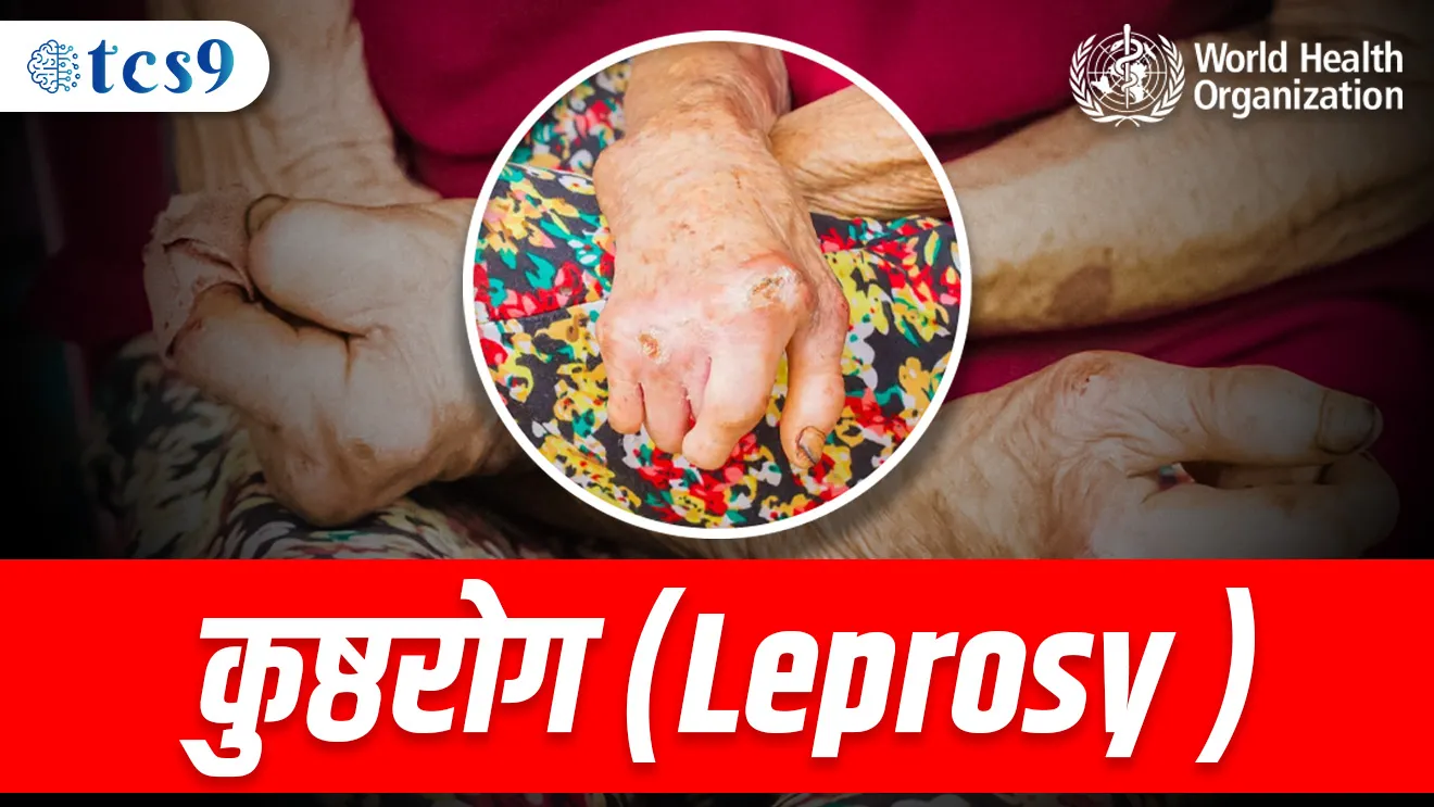( Kushtarog | baba ante | anandavan | jorden | jagatil pahila kushtarog mukt Desh konta ? | Kushtarogachi lakshane | kushtarog jivanu | MPSC science questions | Rog ani ajar | who | World health organisation )( tcs chalu ghadamodi | ibps chalu ghadamodi | current Affair | chalu Ghadamodi Marathi | current Affair marathi madhe | 2024 cha chalu Ghadamodi | police Bharti chalu Ghadamodi | police Bharti prashnasanch | police Bharti GK prashna | Mpsc chalu Ghadamodi | sarkari Naukri | sarkari job | sarkari yojna | Maharashtra cha chalu Ghadamodi | Maharashtra government yojna | PSI syllabus | PSI cutoff | police Bharti syllabus | police Bharti cutoff | police Bharti merit | MPSC Sathi book | MPSC Sathi pustak | police Bharti Sathi pustak | police Bharti magil prashnapatrika | MPSC previous years question papers | Mumbai police Bharti | Mumbai police Bharti Lekhi kadhi ahe | government GR | police Bharti result | MPSC result | SSC GD merit | sscgd syllabus | army Bharti merit | army Bharti result | UPSC Marathi | combine pariksha | talathi | talathi syllabus | talathi cutoff | talathi book list | talathi result | talathi merit | talathi jaga kiti ahe | saralseva exam | saralseva pariksha | saralseva result | zilha parishad Bharti | zilha parishad prashnapstrika )