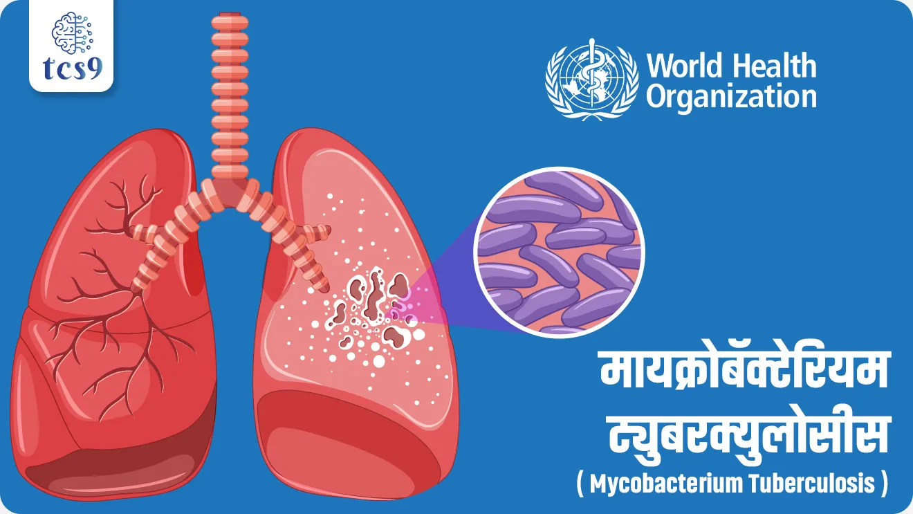 क्षयरोग (TB) आजार कसा होतो ?
• क्षयरोग हा मायक्रोबॅक्टेरियम ट्युबरक्युलोसीस (Mycobacterium tuberculosis) नावाच्या जीवाणूंमुळे (Bacteria) होणारा रोग आहे.
• क्षयरोग (TB) हा संसर्ग झालेल्या व्यक्तीच्या खोकल्या किंवा शिंकण्यातील लहान थेंबांच्या श्वासाद्वारे पसरणारा एक जिवाणूजन्य आजार आहे.