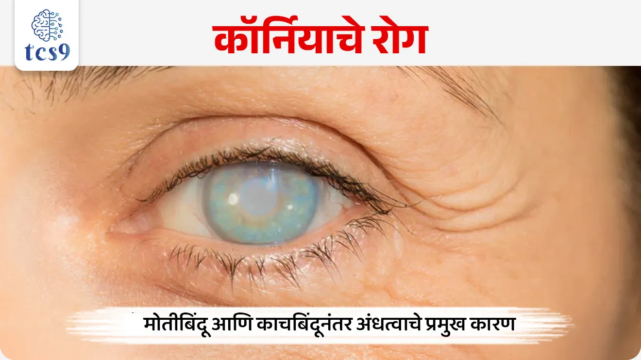 World Eye Donation Day


📚 Subject : GS - दिनविशेष, व्यक्ती विशेष

सरळसेवा, तलाठी, वनरक्षक, पोलीस भरती, अग्निवीर , रेल्वे भरती, SSC GD, MPSC, UPSC परीक्षेसाठी विचारलेले / संभाव्य महत्त्वपूर्ण  प्रश्न

प्रश्न) 'जागतिक दृष्टिदान दिन' केव्हा असतो ? 

1 मे
1 जून
10 जून
15 जून

उत्तर : 10 जून


📰 बातमी काय ?

नेत्रदानाचे महत्व लक्षात घेऊन दरवर्षी 10 जून हा दिवस 'जागतिक दृष्टिदान दिन' ( World Eye Donation Day) म्हणून साजरा करण्यात येतो.
जागतिक दृष्टिदान दिनाला " जागतिक नेत्रदान दिन "  असेही म्हणतात.

🧐 'जागतिक दृष्टिदान दिन' कोणाच्या सन्मानार्थ साजरी करण्यात येतो ? 
सुप्रसिद्ध नेत्र विशारद डॉ. रामचंद्र लक्ष्मण भालचंद्र (Dr. Ramachandra Laxman Bhalchandra) यांच्या  सन्मानार्थ  जागतिक नेत्रदान दिन म्हणून साजरा केला जातो.
१० जून हा दिवस डॉ. भालचंद्र यांचा जन्मदिवस आणि मृत्यू दिन दोन्ही आहे.

✍️ डॉ. रामचंद्र लक्ष्मण भालचंद्र यांबद्दल थोडक्यात माहिती : 

शासकीय सेवेत नेत्रचिकित्सक म्हणून अहोरात्र झटणाऱ्या डॉ. भालचंद्र यांचे नाव महाराष्ट्राच्या इतिहासात अजरामर आहे. 
जन्म : त्यांचा जन्म महाराष्ट्रातील धाराशिव जिल्ह्यात (पूवीचा उस्मानाबाद जिल्हा) 10 जून 1924 रोजी झाला. 
घरची परिस्थिती हलाखीची असूनही जिद्द आणि चिकाटीच्या जोरावर त्यांनी शिक्षण पूर्ण करून नेत्र विशारद पदवी मिळवली.
 डॉ. भालचंद्र यांनी ८० हजारांहून अधिक शस्त्रक्रिया केल्या. 
मृत्यू : 10 जून 1979 ला त्यांचे निधन झाले.  


'जागतिक दृष्टिदान दिन' का साजरी करतात ? 
जागतिक दृष्टिदान दिनाचे उद्दिष्ट कोणते ?

नेत्रदानाद्वारे कॉर्नियाचे रोग, जे मोतीबिंदू आणि काचबिंदूनंतर अंधत्वाचे प्रमुख कारण आहे, यावर उपचार करणे शक्य होते.
लोकांमध्ये नेत्रदानाचे महत्त्व समजावून सांगणे आणि त्याबाबत गैरसमज दूर करणे.
या दिवसाचे औचित्य साधून लोकांमध्ये नेत्रदानाविषयी जनजागृती करणे आणि लोकांना मृत्यूनंतर डोळे दान करण्याची शपथ घेण्यासाठी प्रेरित करणे ज्यामुळे दृष्टीहीन व्यक्तींचे जीवन प्रकाशमय होऊ शकेल. हे जागतिक नेत्रदान दिनाचे महत्वाचे उद्दिष्ट आहे.
एका व्यक्तीच्या नेत्रदानामुळे किमान 2 दृष्टीहीन व्यक्तींना दृष्टी मिळू शकते, ज्यामुळे त्यांचे जीवन सुंदर आणि सुखकर होऊ शकते.
नेत्रदान हे एक महान सामाजिक कार्य आहे, जे मृत्यूनंतरही इतरांना नवीन जीवन देते.


🔑 परीक्षेच्या दृष्टीने IMP रिव्हिजन पॉईंट्स : World Eye Donation Day
 जागतिक दृष्टिदान दिन → 10 जून
कोणाच्या सन्मानार्थ → डॉ. रामचंद्र लक्ष्मण भालचंद्र
 डॉ. भालचंद्र यांचा जन्म → महाराष्ट्रातील उस्मानाबाद (धाराशिव) जिल्ह्यात (10 जून 1924)
निधन→ 10 जून 1979 



World Eye Donation Day, Jagtik Netradan din, jagtik drushtidan din, vishwa Netradan din, International Eye Donation Day, Jagtik Netradan din konacha sanmanarth sajra kartat, Dr. Ramachandra Laxman Bhalchandra, Which day is eye donation day?, What is eye donation called?, Cornea Donation, dole, dolyanche ajar, motibindu,



प्रश्न) दरवर्षी 10 जून रोजी साजरा केला जाणारा 'जागतिक दृष्टिदान दिन' (World Eye Donation Day) महाराष्ट्रातील कोणत्या व्यक्तीच्या सन्मानार्थ साजरा केला जातो ?
1. डॉ. रामचंद्र लक्ष्मण भालचंद्र
2. डॉ. तात्याराव लहाने
3. डॉ. भालचंद्र नेमाडे
4. डॉ. प्रकाश आमटे

उत्तर :  डॉ. रामचंद्र लक्ष्मण भालचंद्र

शासकीय सेवेत नेत्रचिकित्सक म्हणून अहोरात्र सेवा देणारे महाराष्ट्रातील थोर डॉक्टर डॉ. रामचंद्र लक्ष्मण भालचंद्र यांच्या सन्मानार्थ 10 जून हा दिवस 'जागतिक दृष्टिदान दिन' म्हणून साजरा केला जातो. 
त्यांनी आपल्या कारकिर्दीत 80,000 हून अधिक नेत्र शस्त्रक्रिया केल्या होत्या.




प्रश्न 2) 'जागतिक दृष्टिदान दिनाबाबत' खालील विधानांचा विचार करा :
अ) दरवर्षी 10 जून हा दिवस जगभरात 'जागतिक दृष्टिदान दिन' (World Eye Donation Day) म्हणून साजरा केला जातो.
ब) हा दिवस महाराष्ट्रातील प्रसिद्ध नेत्र विशारद डॉ. तात्याराव लहाने यांच्या सन्मानार्थ आणि स्मृतीप्रत्यर्थ साजरा केला जातो.

वरीलपैकी कोणते/कोणती विधान/विधाने बरोबर आहेत ?
१) फक्त अ
२) फक्त ब
३) अ आणि ब दोन्ही बरोबर
४) अ आणि ब दोन्ही चूक

उत्तर : फक्त अ

 ❌ विधान ब चुकीचे आहे कारण : 
10 जून हा दिवस महाराष्ट्रातील शासकीय सेवेत 80,000 हून अधिक शस्त्रक्रिया करणाऱ्या डॉ. रामचंद्र लक्ष्मण भालचंद्र यांच्या सन्मानार्थ साजरा केला जातो.
 10 जून हा डॉ. भालचंद्र यांचा जन्म व मृत्यू दिन आहे.